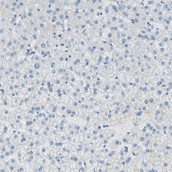 SLC22A2/OCT2 Antibody, Novus Biologicals:Antibodies:Primary Antibodies